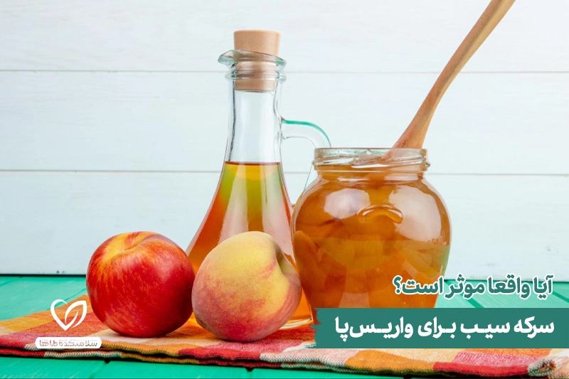 همه چیز درباره سرکه سیب درمان قطعی واریس پا سرکه سیب درمان قطعی واریس پا
