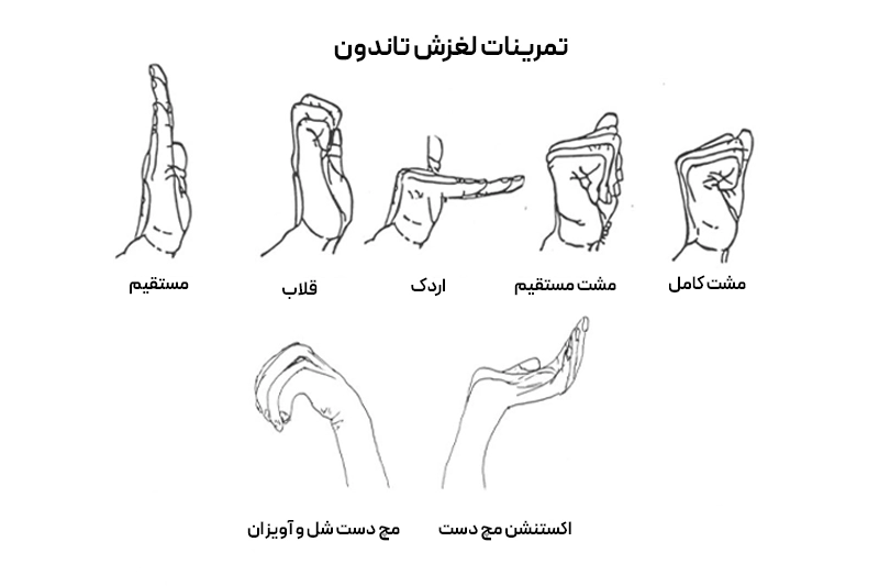 سندرم تونل کارپال چیست؟ تصویر ۷ نوع تمرین ورزشی ویژه برای بهبود حرکت عصب مدیان، تاندونها و انعطافپذیری مچ دست.