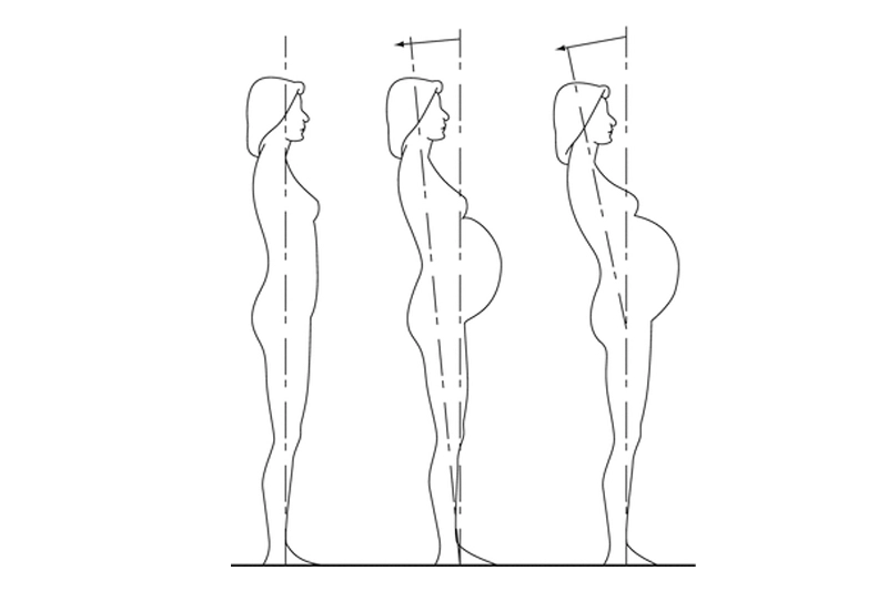 کایروپراکتیک در بارداری نمایش ایستادن طبیعی و تغییر مرکز ثقل بدن به جلو در دوران بارداری به دلیل افزایش وزن شکم
