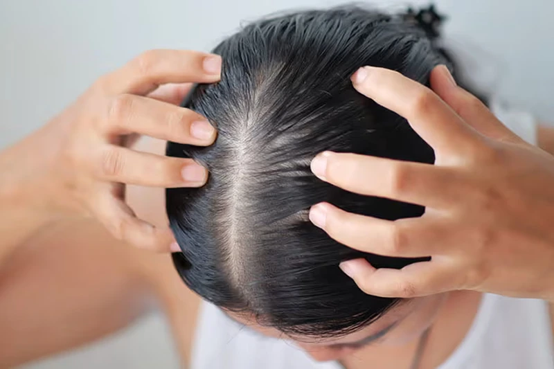 زن با استفاده از روغن بابونه پوست سر خود را ماساژ می‌دهد برای تقویت و محافظت از مو. 