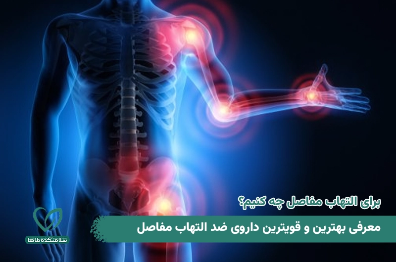 بهترین و قویترین داروی ضد التهاب مفاصل بهترین و قویترین داروی ضد التهاب مفاصل